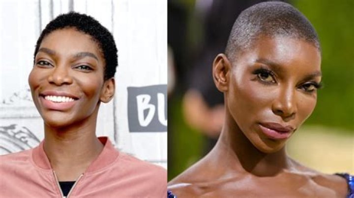 Uncovering Michaela Coel's Journey Before Surgery: Insights And Discoveries Await